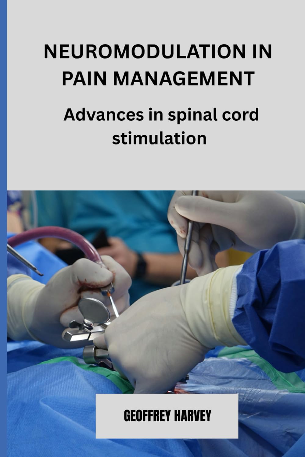 Neuromodulation in Pain Management: Advances in Spinal Cord Stimulation