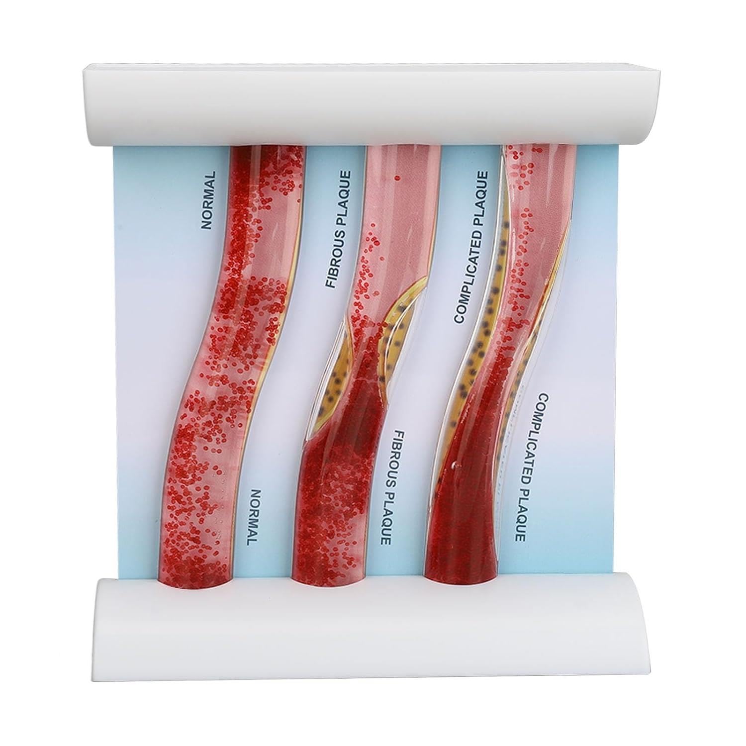 Modelo dinámico vena arterial, material anatómico vaso sanguíneo humano