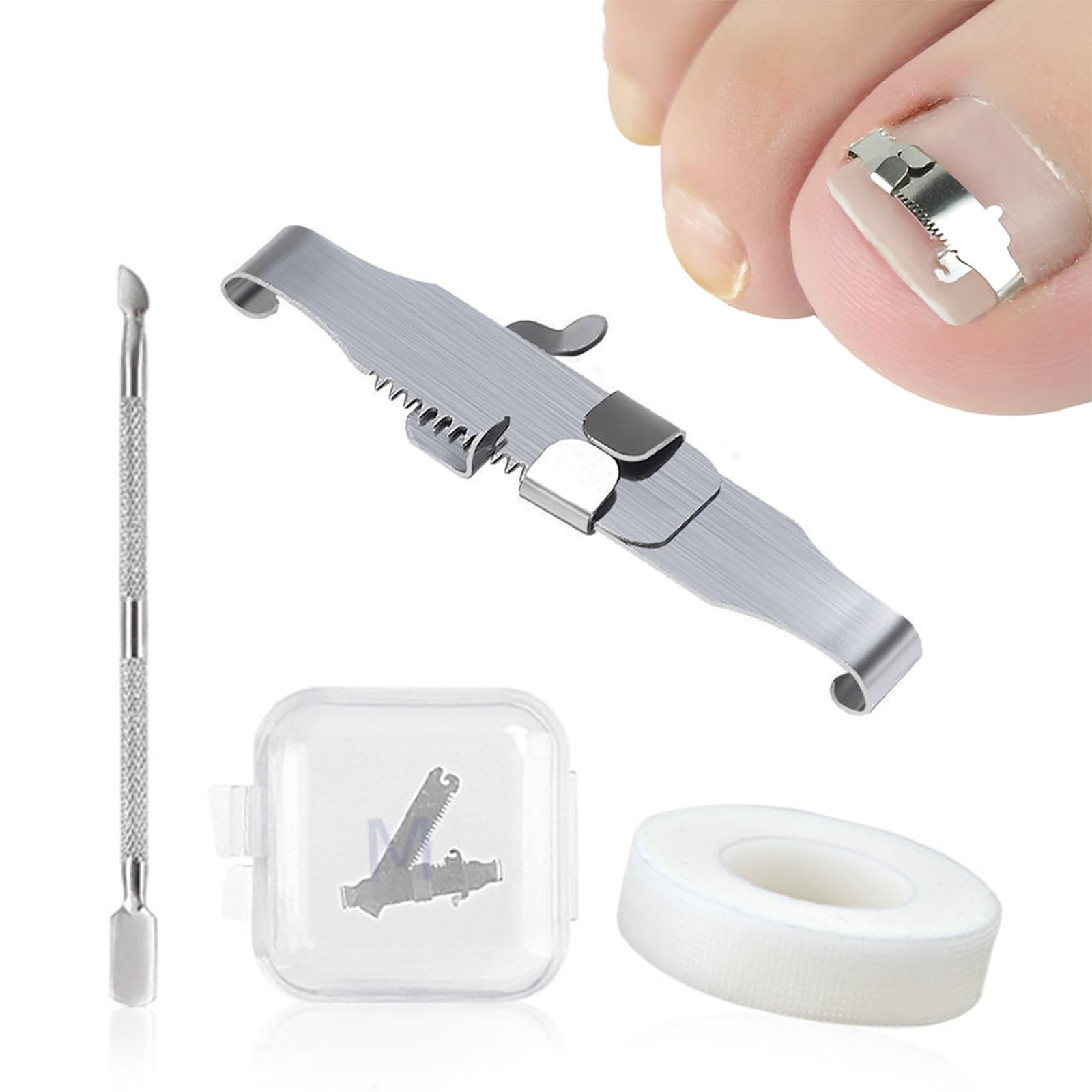 2Pcs Strumenti Per Unghie Incarnite, Fibbia Per Correzione Delle Unghie Dei Piedi Incarnite e Trattamento Della Paronichia, In Acciaio Inox Chirurgico