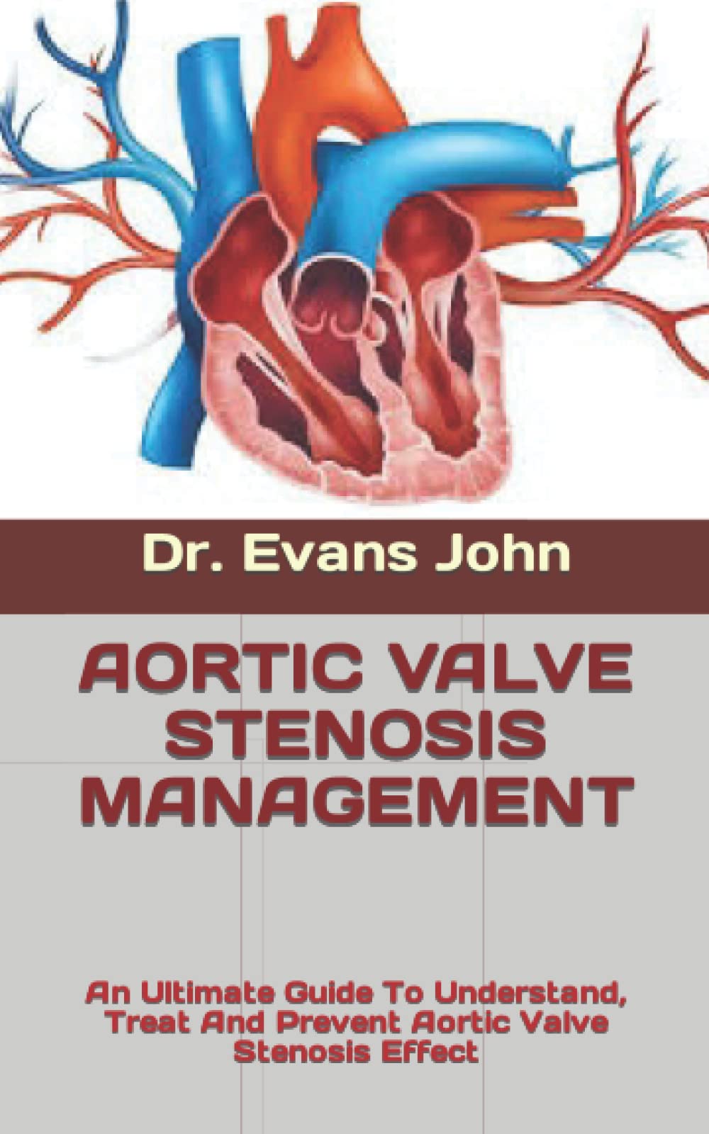 Buy AORTIC VALVE STENOSIS MANAGEMENT An Ultimate Guide To Understand