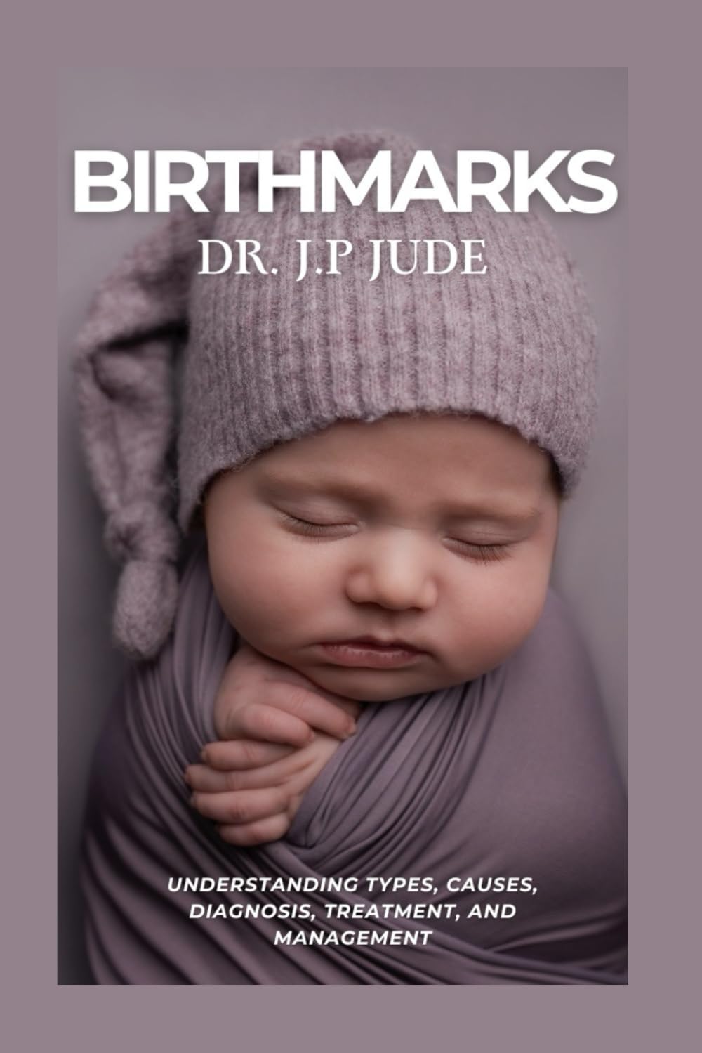 BIRTHMARKS: UNDERSTANDING TYPES, CAUSES, DIAGNOSIS, TREATMENT, AND MANAGEMENT