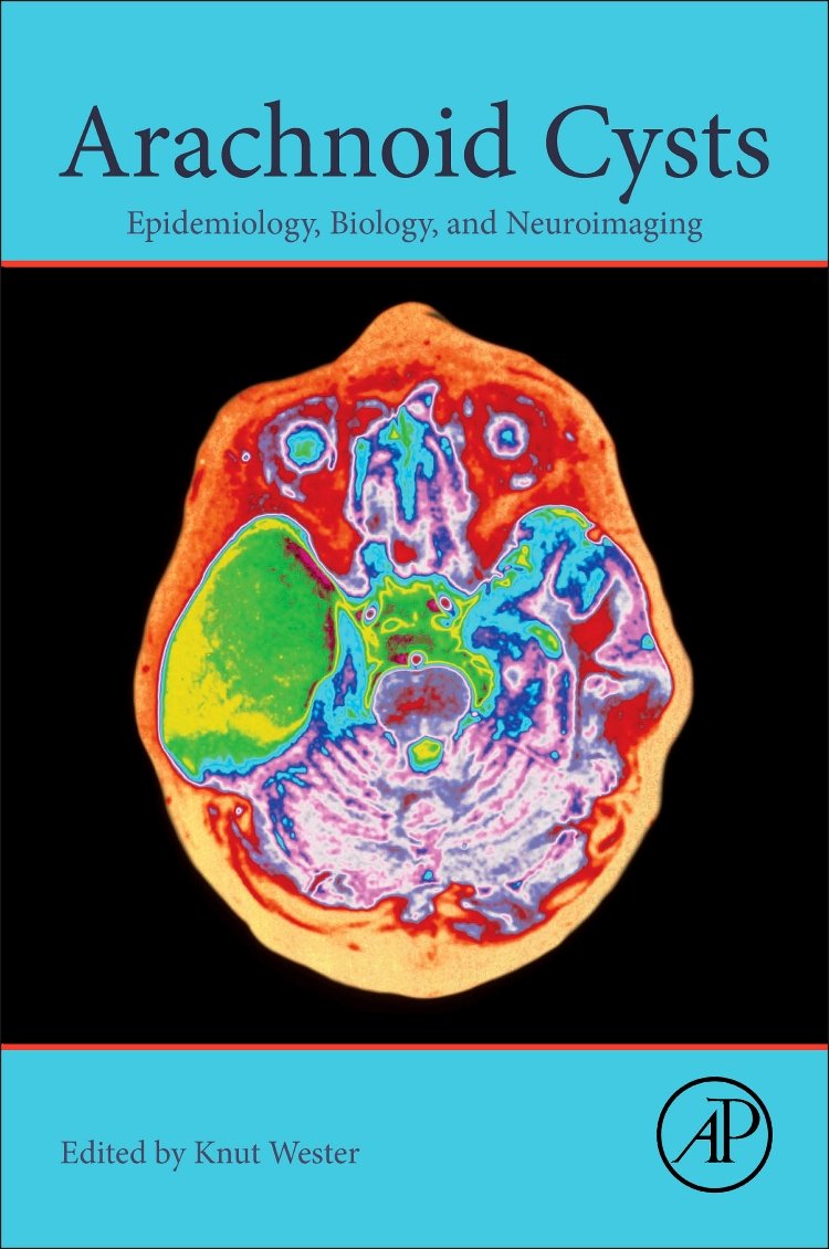 Arachnoid Cysts: Epidemiology, Biology, and Neuroimaging