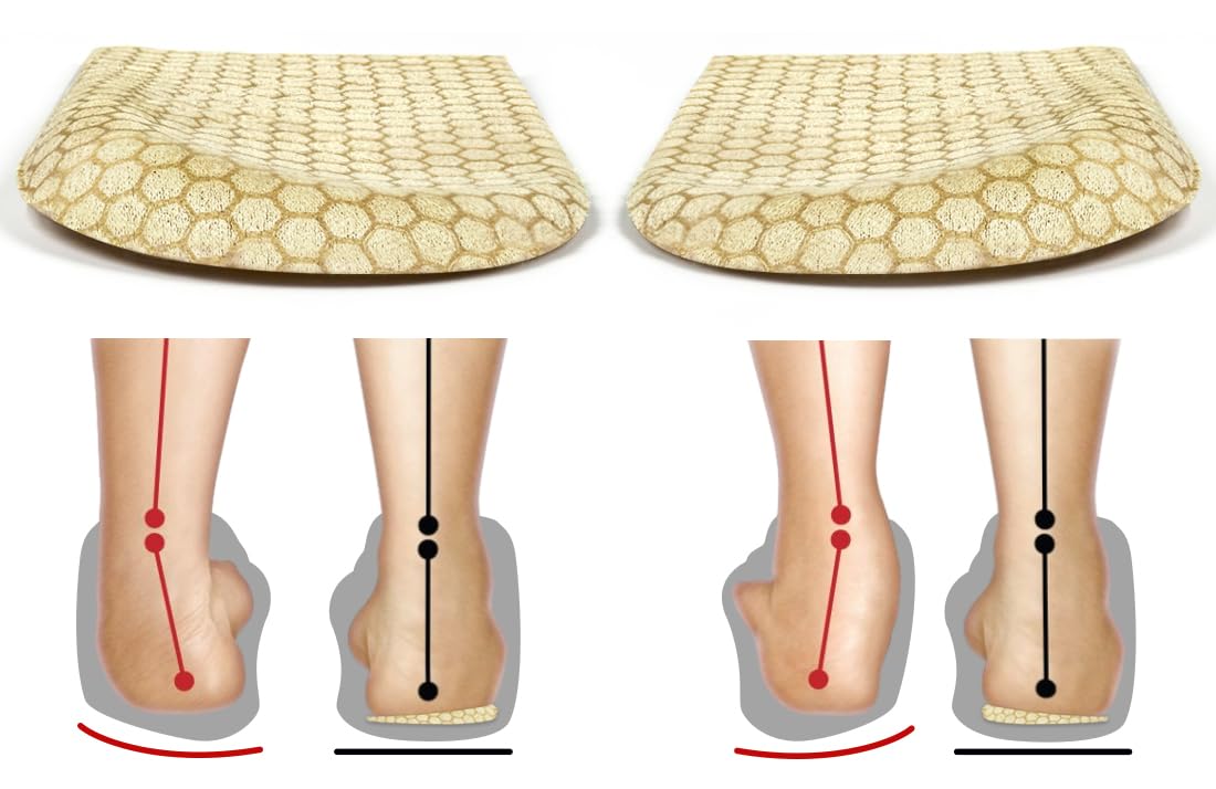 BIGGCOOL Corrective Insoles for Supination & Over-Pronation, Orthotics Medial & Lateral Heel Wedge Inserts for Foot Alignment, Bow Legs, Knee Pain (Beige-1 Layer, L: Women 8-12/Men: 7.5-13)