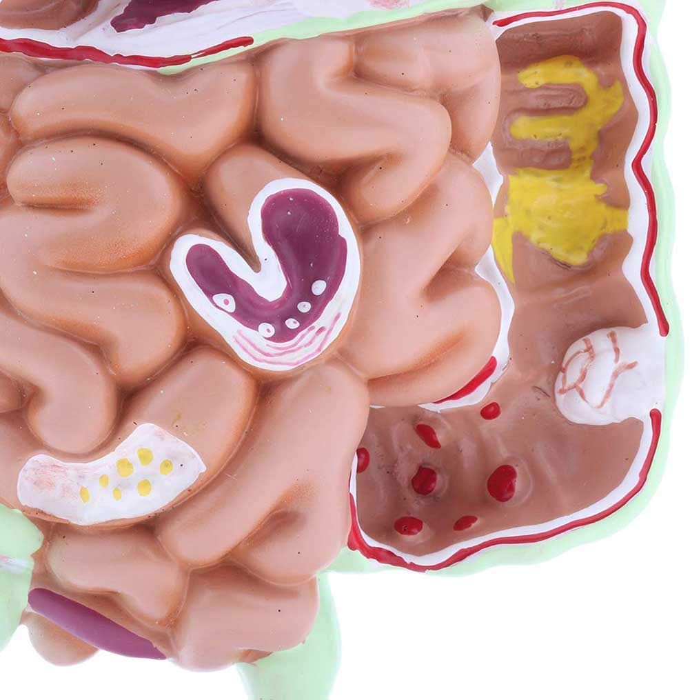 Anatomia patologiczny model ludzkiego okrężnicy model żołądkowo-jelitowy Des digestive do szkoły badania anatomiczne wyświetlacz model szkieletu
