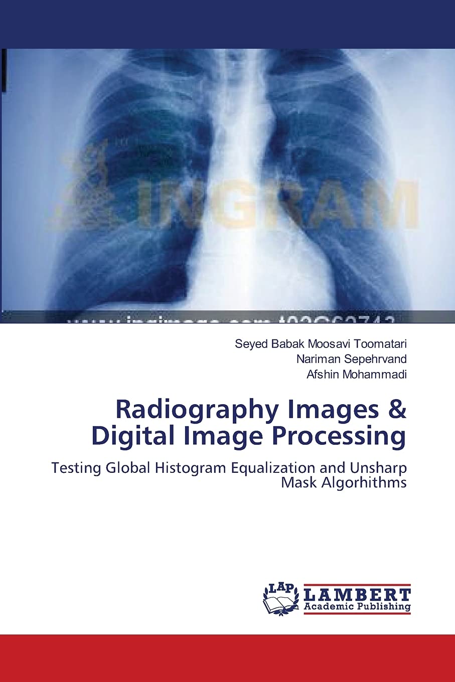 Radiography Images & Digital Image Processing Testing Global Histogram