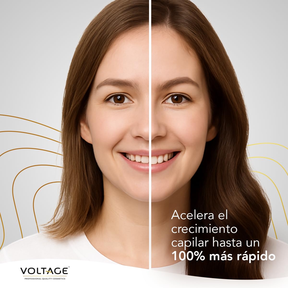 Voltage Cosmetics - Acelerador Capilar - 200ml - Estimula Crecimiento de las Fibras Capilares - Prebiotic Hair Technology - Protección del cuero cabelludo
