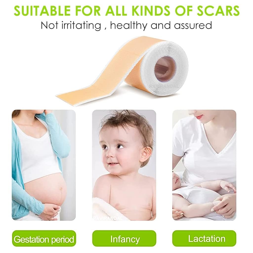 RAVIRANDAL Silicone Scar Sheets, Silicon gel sheets for Scars Transparent Medical Silicone Gel Tape for Scar Removal, Silicone Scar Tape Roll For Hypertrophic Scars and Keloids Caused by Surgery 4