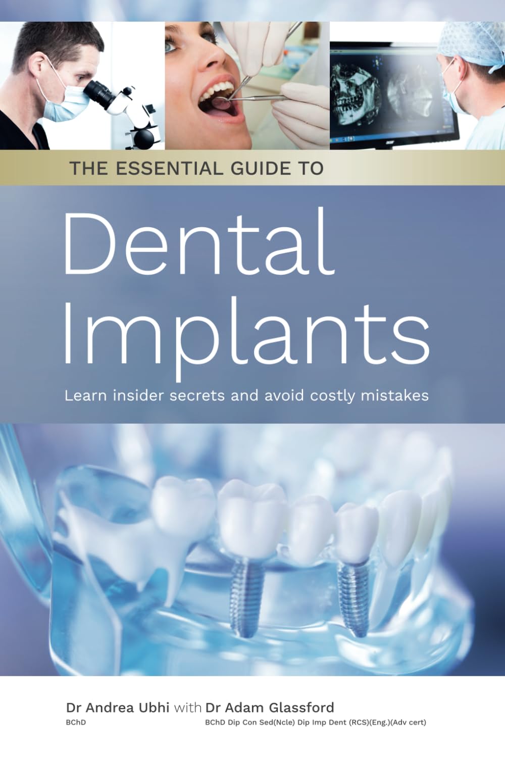 The Essential Guide to Dental Implants: Learn Insider Secrets and Avoid Costly Mistakes