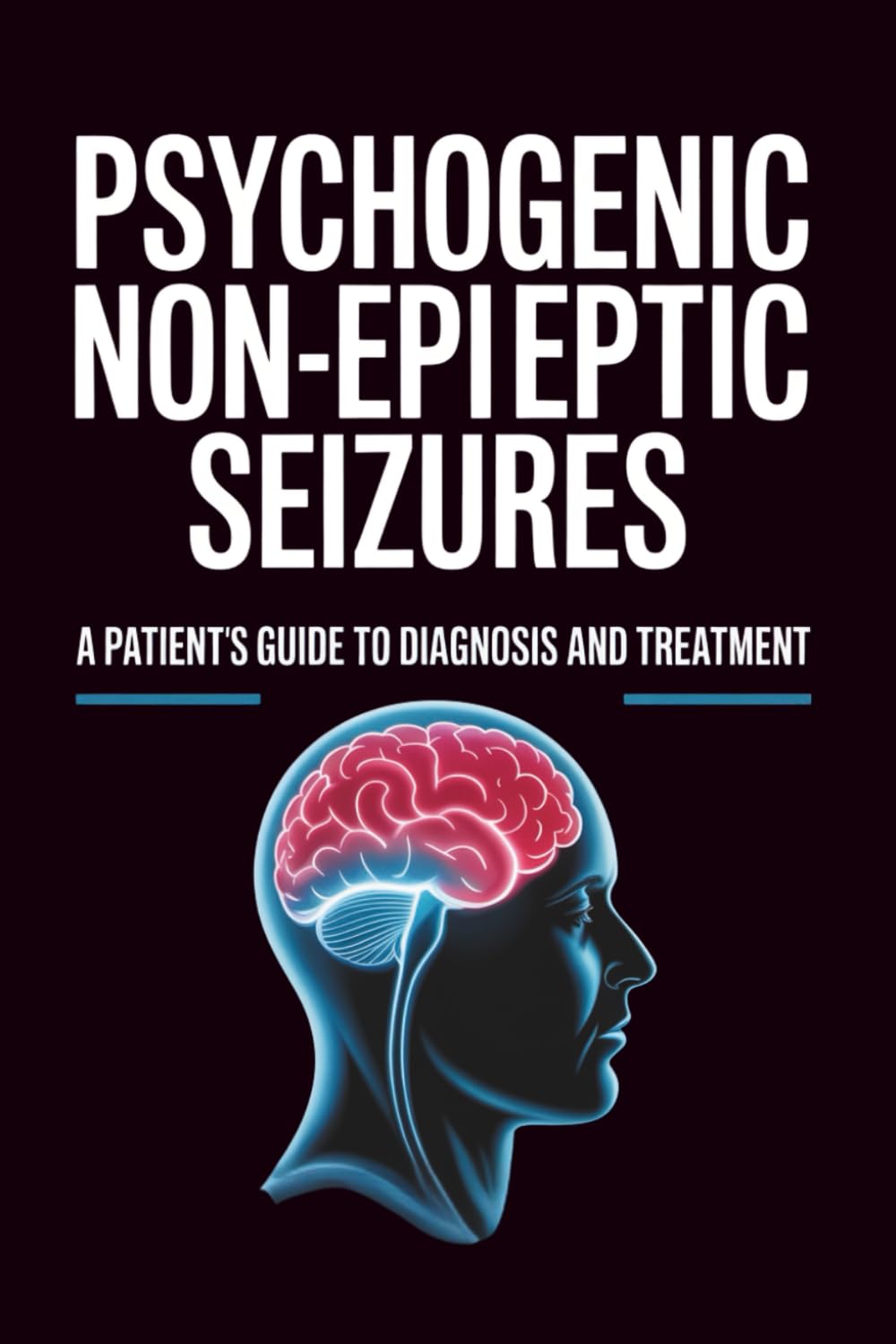 Psychogenic Non-Epileptic Seizures: A Patient’s Guide to Diagnosis And Treatment
