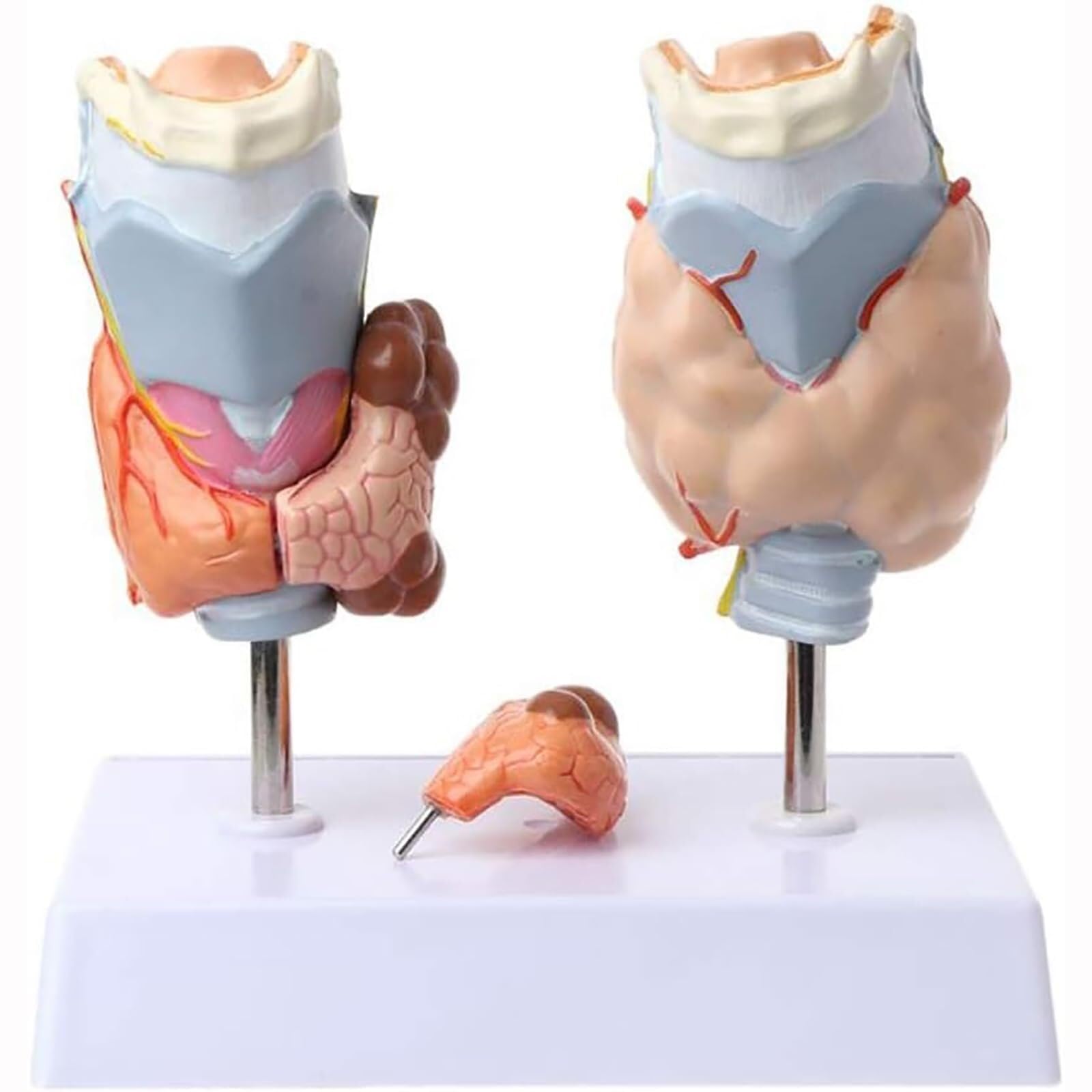 model anatomiczny, Model torbieli guza gardła tarczycy
