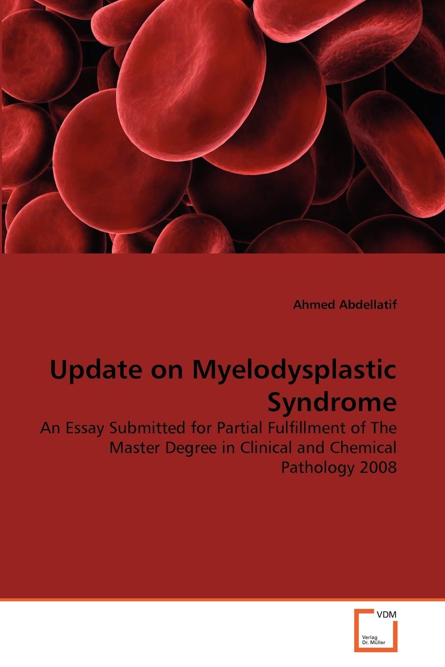 Update on Myelodysplastic Syndrome