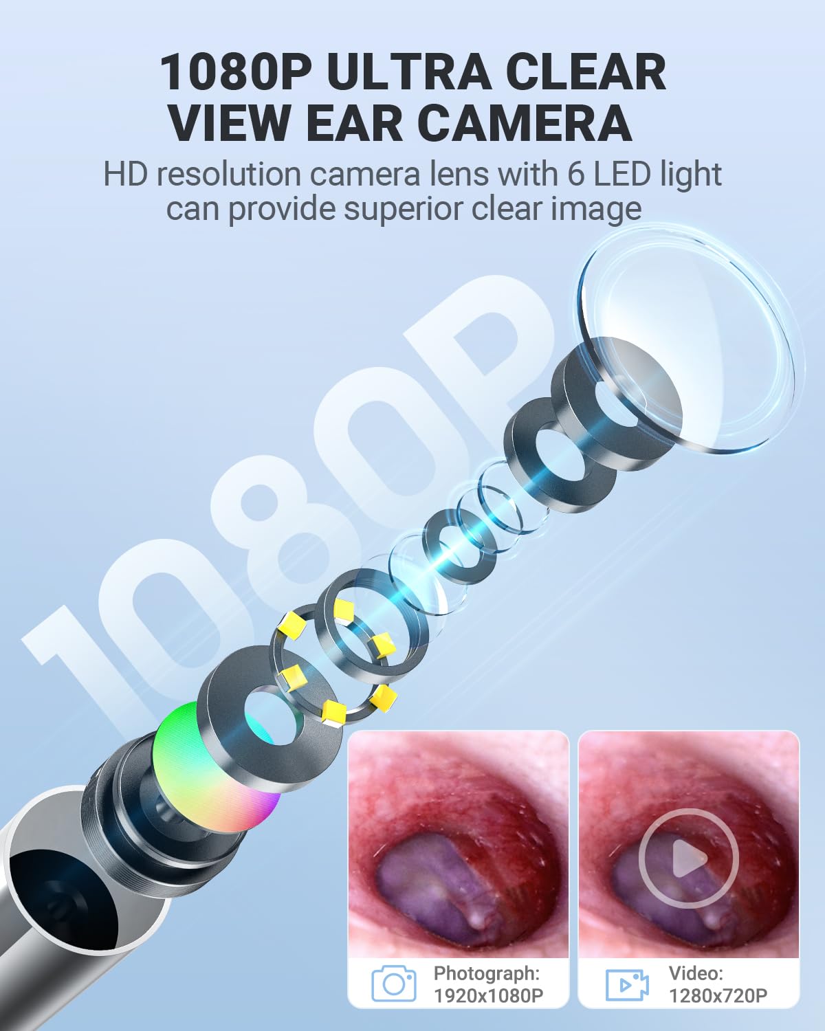 1080P Digitales Otoskop mit Gyroskop, AnyScope 3,9 mm Ohrfernrohrkamera mit 6 Lichtern, 11,4 cm Bildschirm, Ohrenschmalz-Entfernungswerkzeug, 32 GB Karte, unterstützt Foto-Schnapp- und Videoaufnahmen