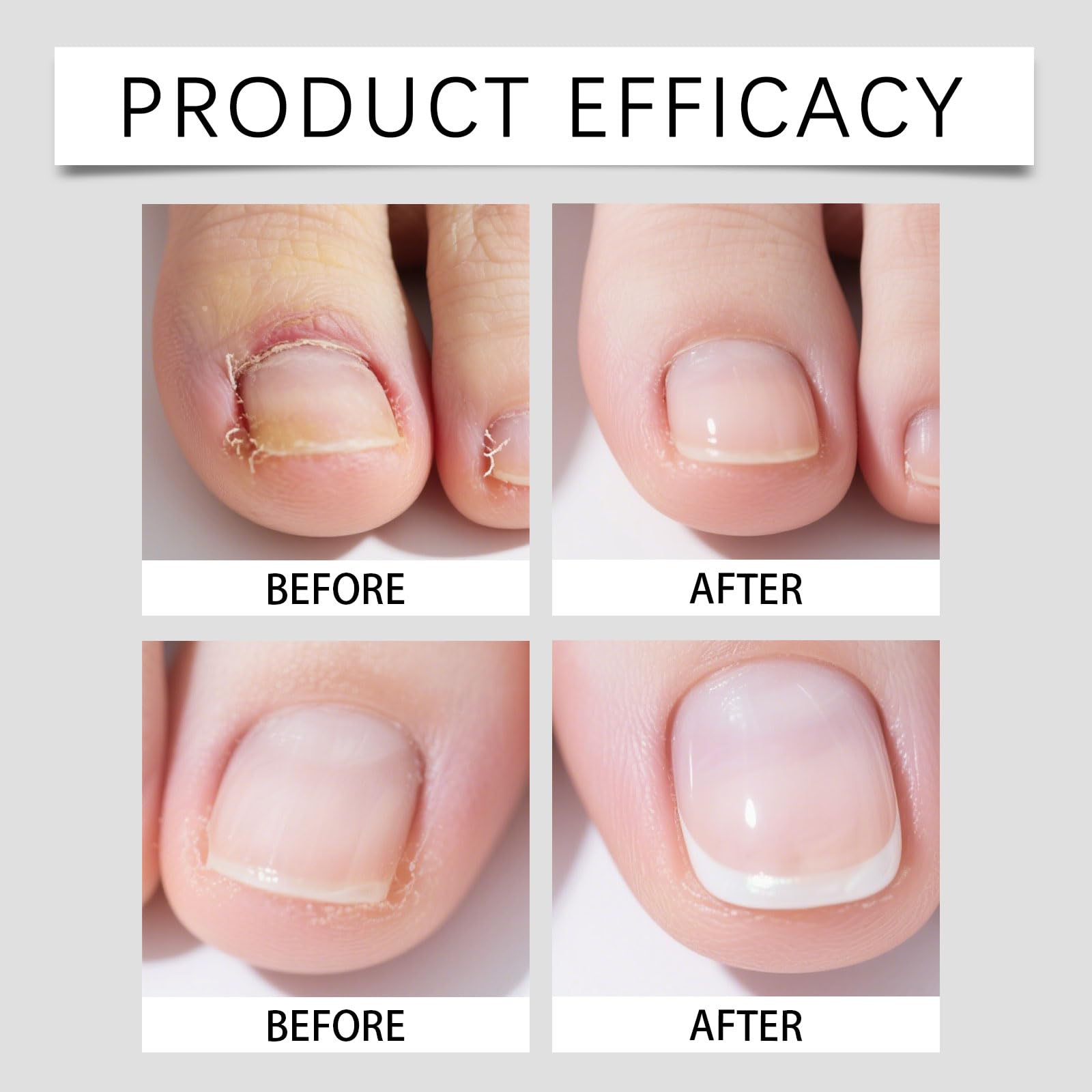 Crème renforçante ongles faibles et endommagés, répare les fissures. (8PCS)