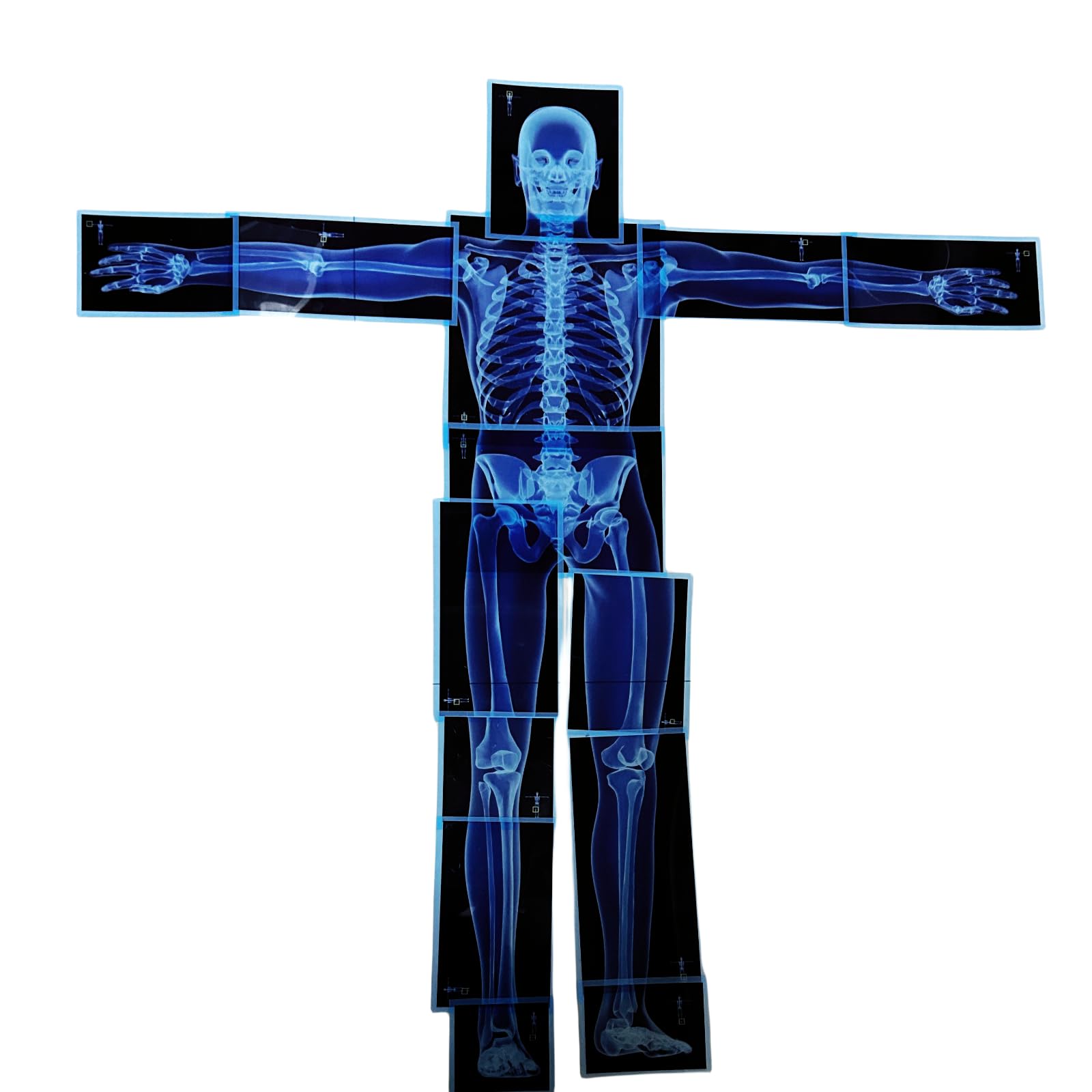 21pcs Human Body Xrays for Kids Educational Set | X Rays for Classroom | Toddler X Ray Toy | Skeleton Xray | X-Ray Science Kit |STEM/STEAM Science Materials for Classroom & Home | Size 33.85" X 35.82"