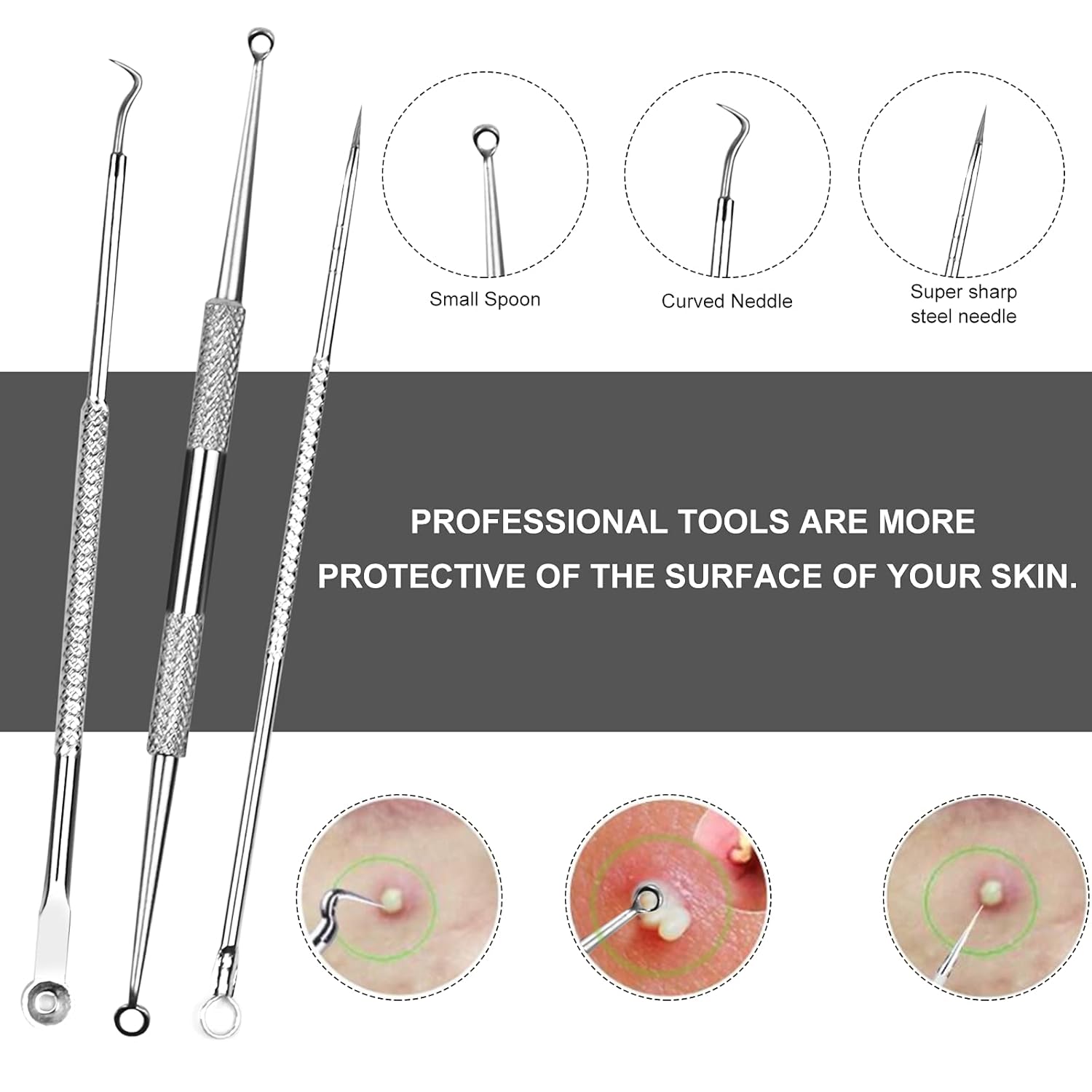 Fluco Blackhead Remover Pimple Popper Tool Kit, 8pcs Blackhead Comedone Extractor Tool for Nose Face, Blemish Whitehead Extraction Popping, Stainless Silver : Beauty & Personal Care