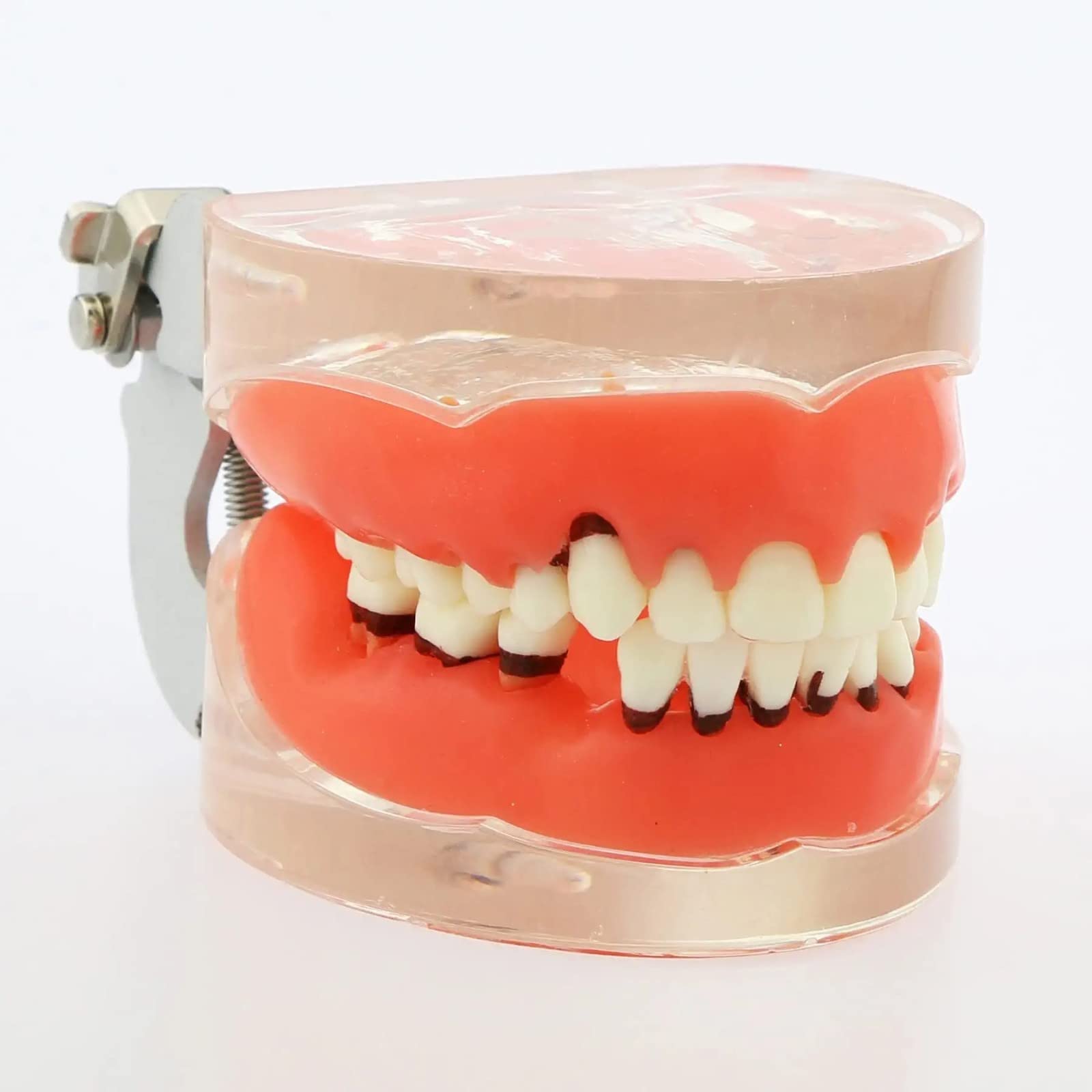 Modello Denti per Malattia Parodontale per Studio Odontoiatrico, Typodont con Gomme Morbide per Insegnamento e Formazione in Odontoiatria, Strumento Educativo Anatomico