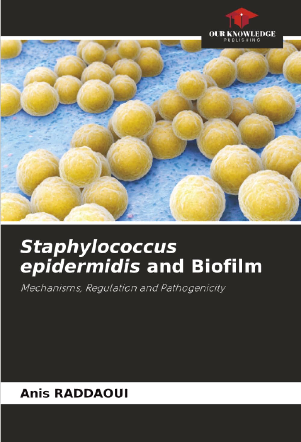 Staphylococcus epidermidis and Biofilm: Mechanisms, Regulation and Pathogenicity