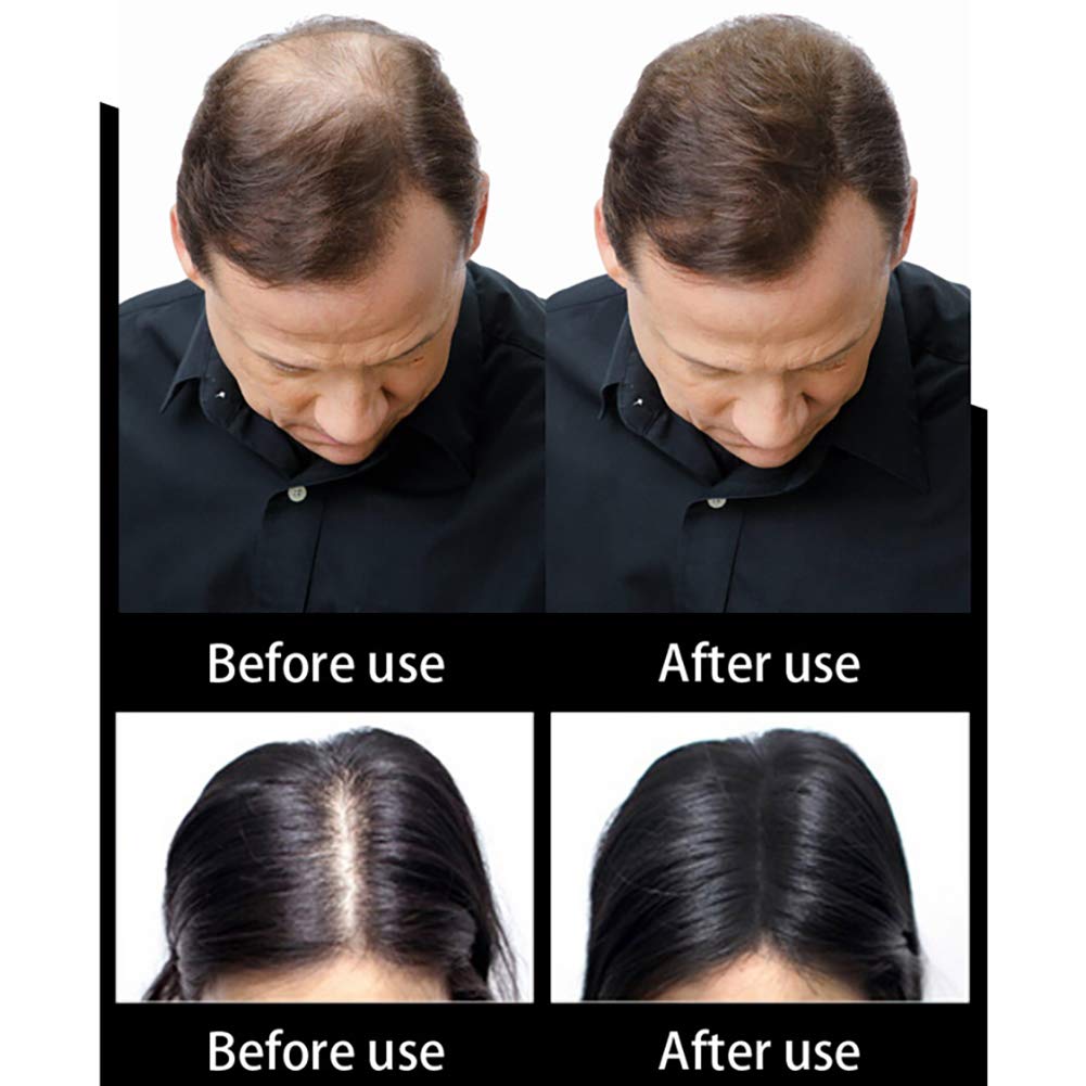 Fibras de Cabello Naturales para Cabello Fino y Escaso, Efecto Inmediato (Marron oscuro)