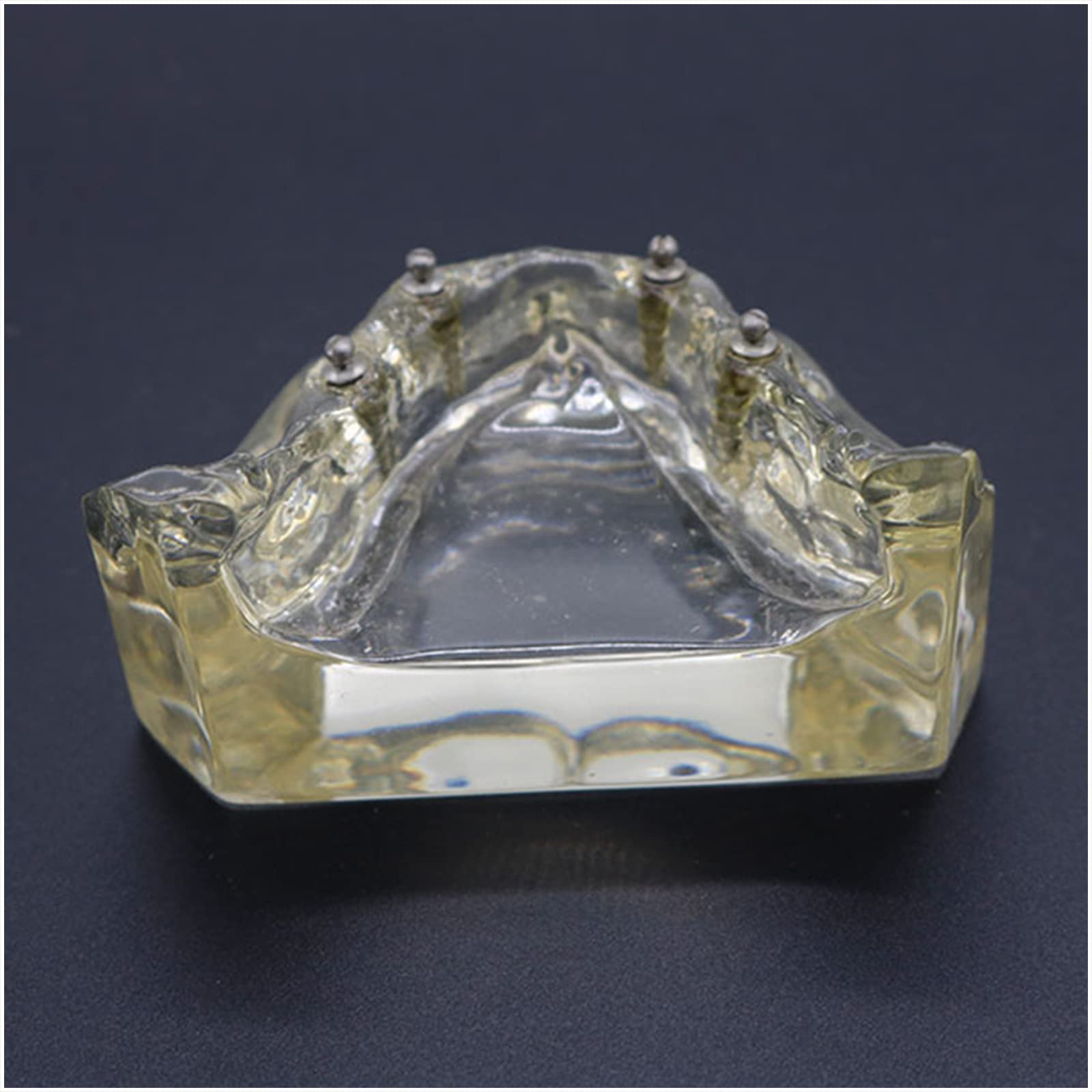 Implant Typodont model zębów - model szkoleniowy implantu dentystycznego - z miękkimi dziąsłami, do nauczania przedmiotów ścisłych, narzędzie komunikacji lekarz-pacjent (B)