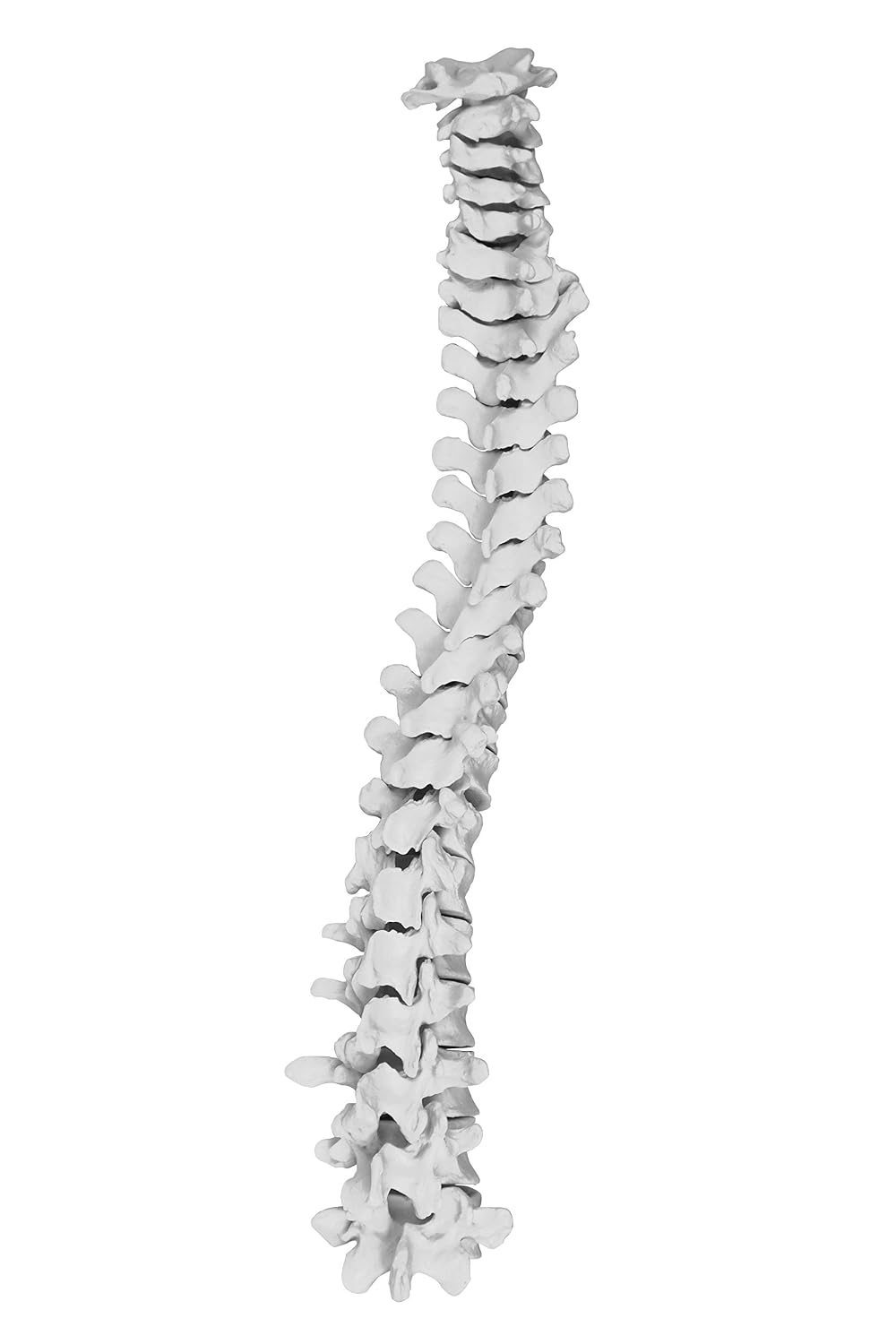 VAS220-CC0 Life Size, Total Disarticulated Skeleton | Bones & Osteological Features Numbered for Identification | 3-Part Skull | Key to Numbered Structures W Manual & Carrying Case