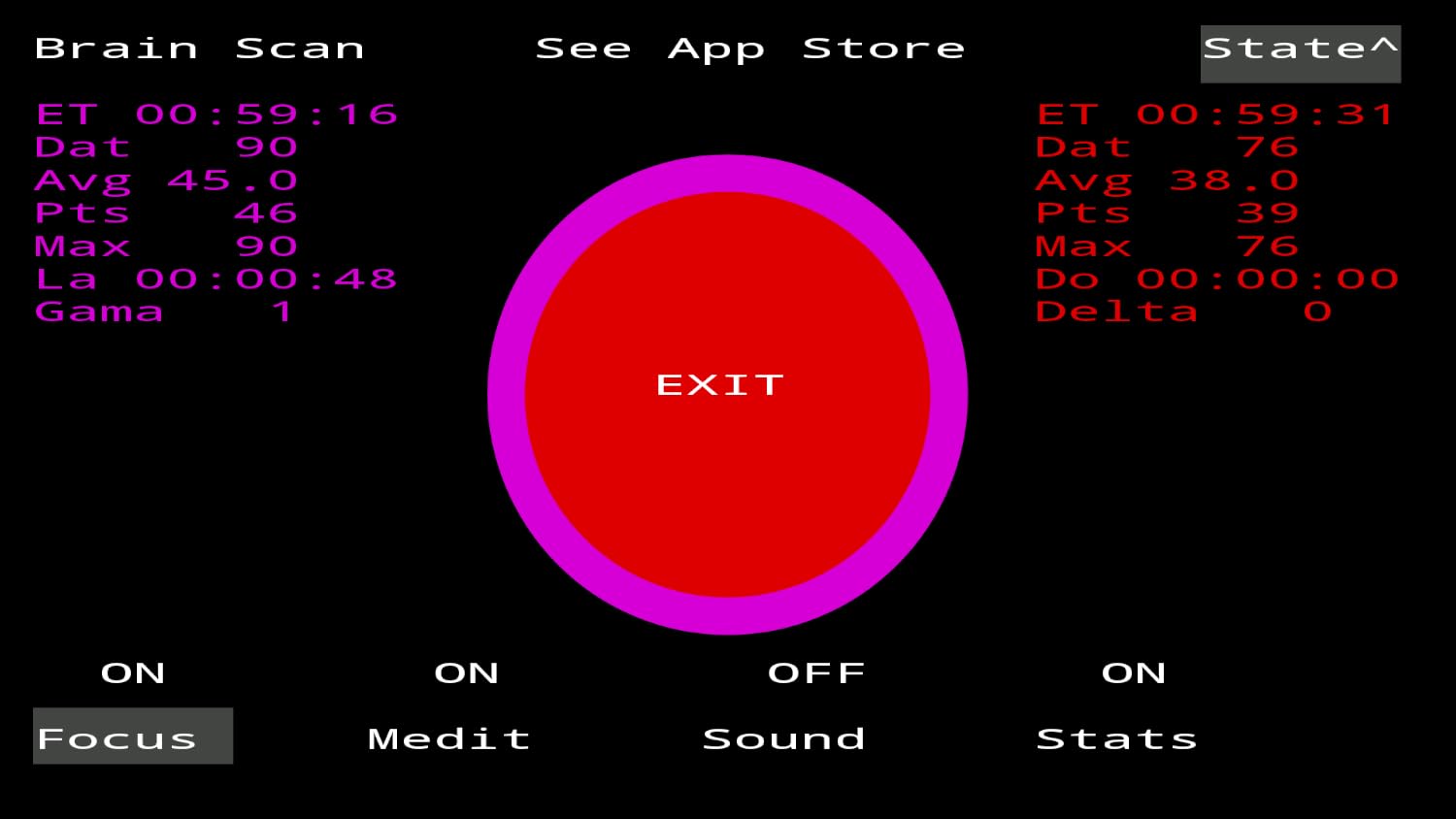 Vue 6