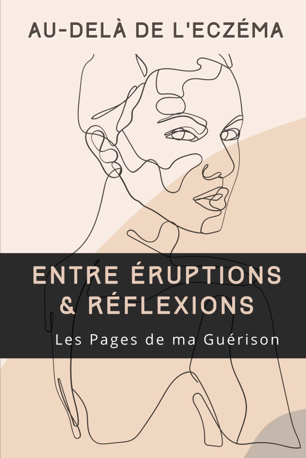 Au-delà de l'Eczéma: Entre Éruptions et Réflexions , Les Pages de ma Guérison (French Edition)