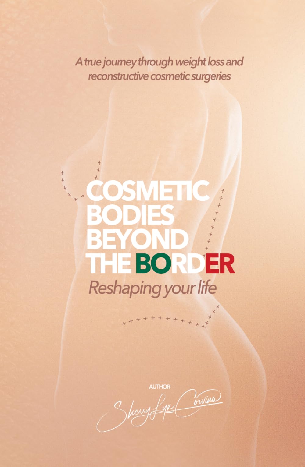 Cosmetic Bodies Beyond the Border: Reshaping Your Life With Confidence Through Cosmetic Surgery Abroad: A true journey through weight loss and reconstructive cosmetic surgeries