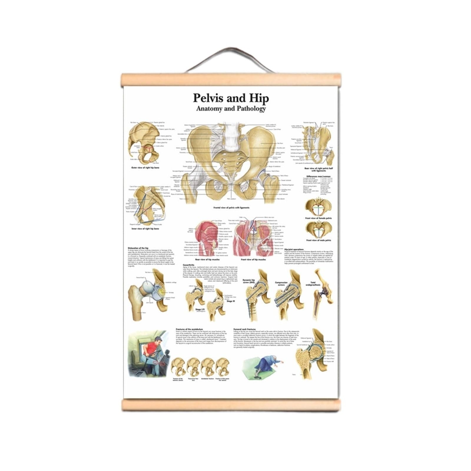 Plakat Z Miednicą I Biodrami Drukuje Wykres Ścienny Anatomia Człowieka Obraz Płótno Artystyczne Przewiń Malowanie Szpitale Kliniki Fototapeta Dekoracyjna Do Domu(Scroll Painting,50X70 CM)