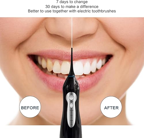 Miniatura 6 de Hilo dental TOVENDOR eléctrico, para agua, irrigador bucal dental inalámbrico, 3 modos, 3 puntas para higiene familiar (10.1 onzas, hilo dental