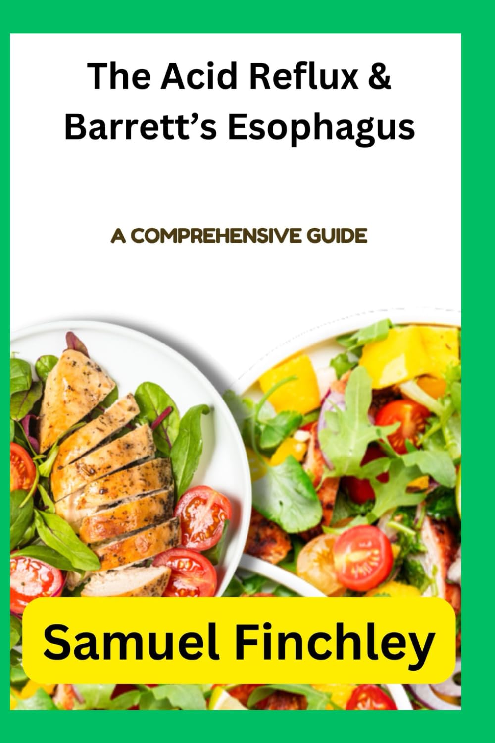 The Acid Reflux & Barrett’s Esophagus: A Comprehensive Guide