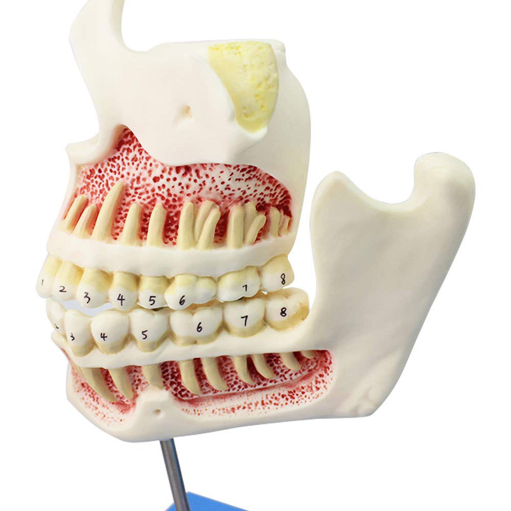 Denti Decidui Denti Permanenti Modello Sviluppo Dei Denti E Mascella Bambini Crescita Denti 4Stadi Modello Sviluppo Dentatura E Della Mascella Bambini Cura Dentale Orale Mascella Dentatura Denti