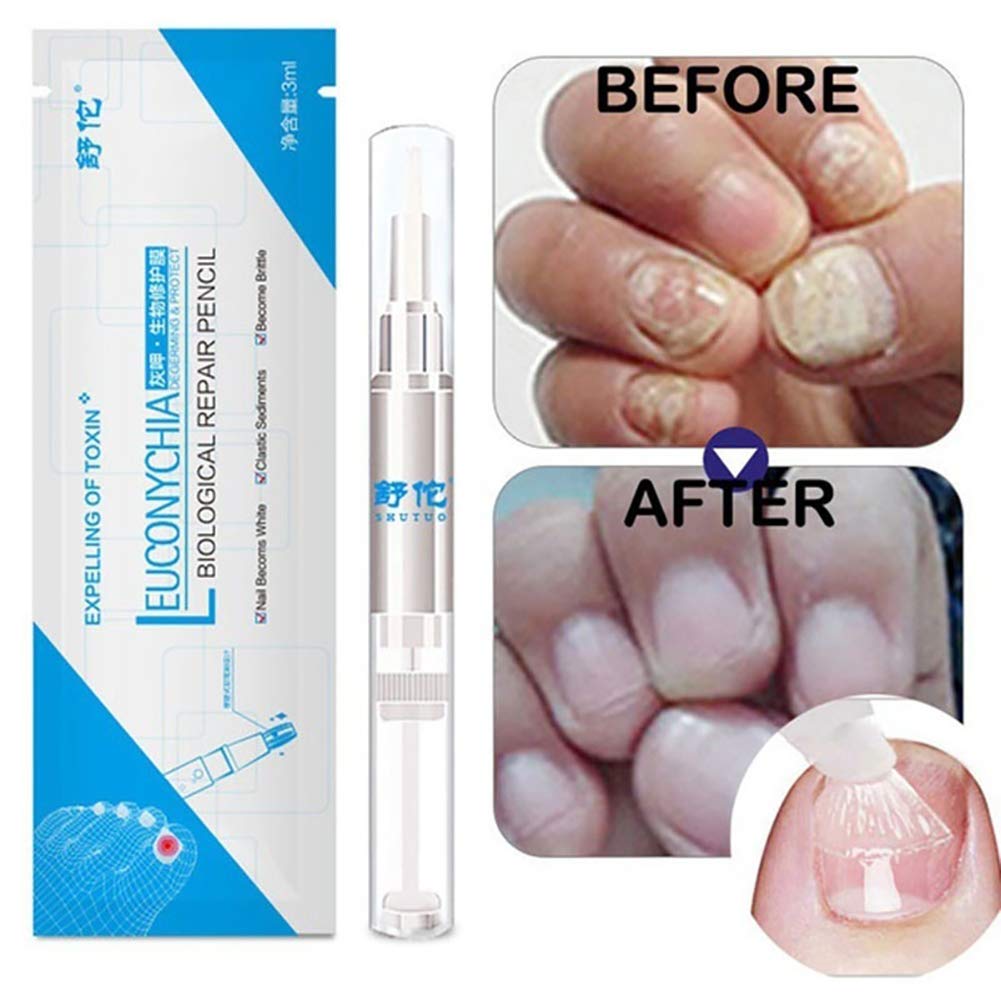Buy Toenail Fungus , AntiFungal Nail Solution Kills fungus on