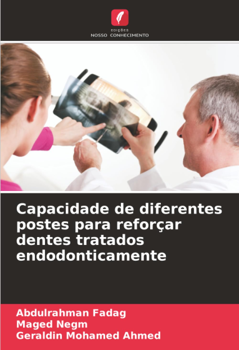 Capacidade de diferentes postes para reforçar dentes tratados endodonticamente