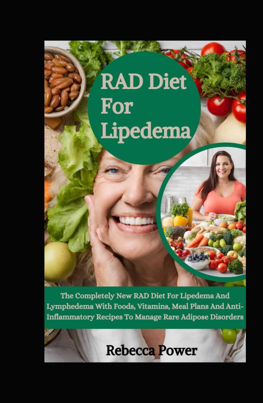 RAD Diet For Lipedema: The Completely New RAD Diet For Lipedema And Lymphedema With Foods, Vitamins, Meal Plans And Anti-Inflammatory Recipes To Manage Rare Adipose Disorders