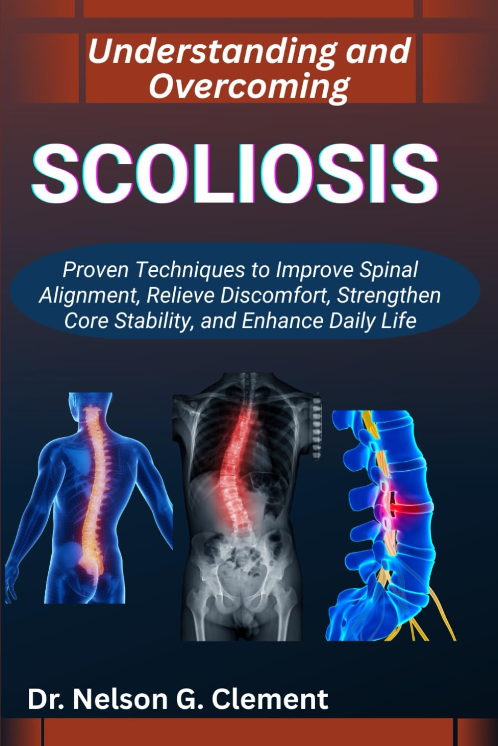 UNDERSTANDING AND OVERCOMING SCOLIOSIS: Proven Techniques to Improve Spinal Alignment, Relieve Discomfort, Strengthen Core Stability, and Enhance Daily Life