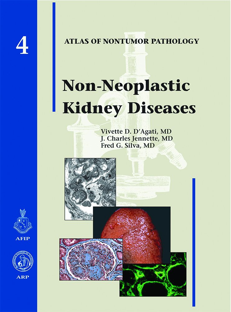 Non-Neoplastic Kidney Diseases