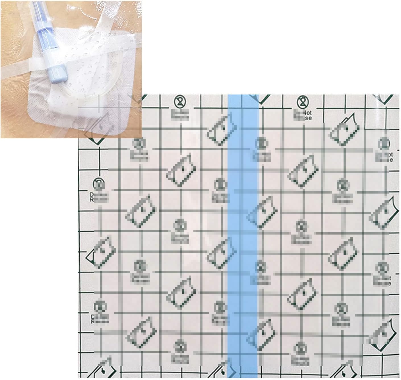 GAOZHEN PelíCula Impermeable para DiáLisis Peritoneal Profesional, PelíCula Protectora Desechable De PU, Pegatina Peritoneal para Bolsa De BañO, Productos De Cuidado Especial para Pacientes,F,300pcs