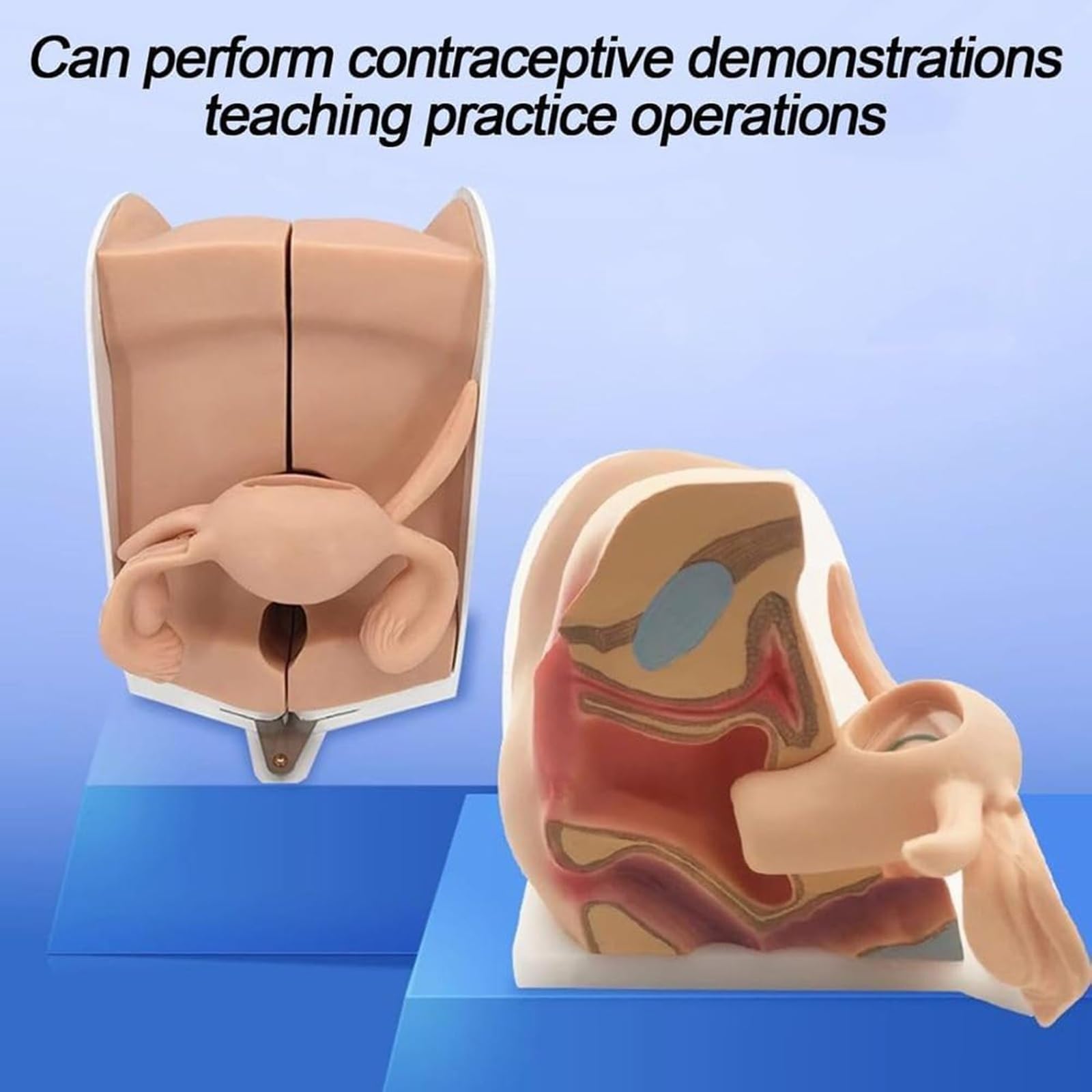 Modello Didattico di Contraccezione Femminile, Modello di Anatomia Genitale Ginecologica per la Guida alla Contraccezione e l'Educazione Medica