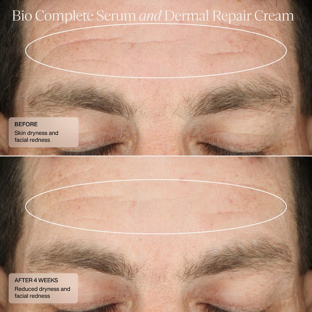 Senté Bio Complete Serum | Retinoid Serum for Sensitive Skin | Gentle, Nourishing & Hydrating | Combats Dull and Aging Skin | 1.0 Fl Oz