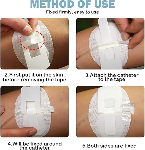 Miniatura 3 de 20 unidades de dispositivo de estabilización de catéter, soportes para tubo de alimentación, parche de diálisis PD, soporte para piernas, soporte