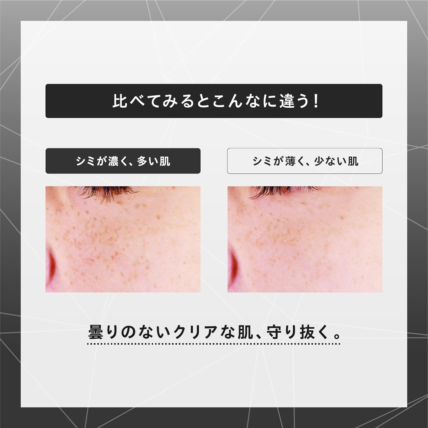 KOSÉ IMPREA WHITENING LASER SHOT 50mL ONE BY KOSE Melano Shot W Mini Size 10mL Whitening Serum Whitening