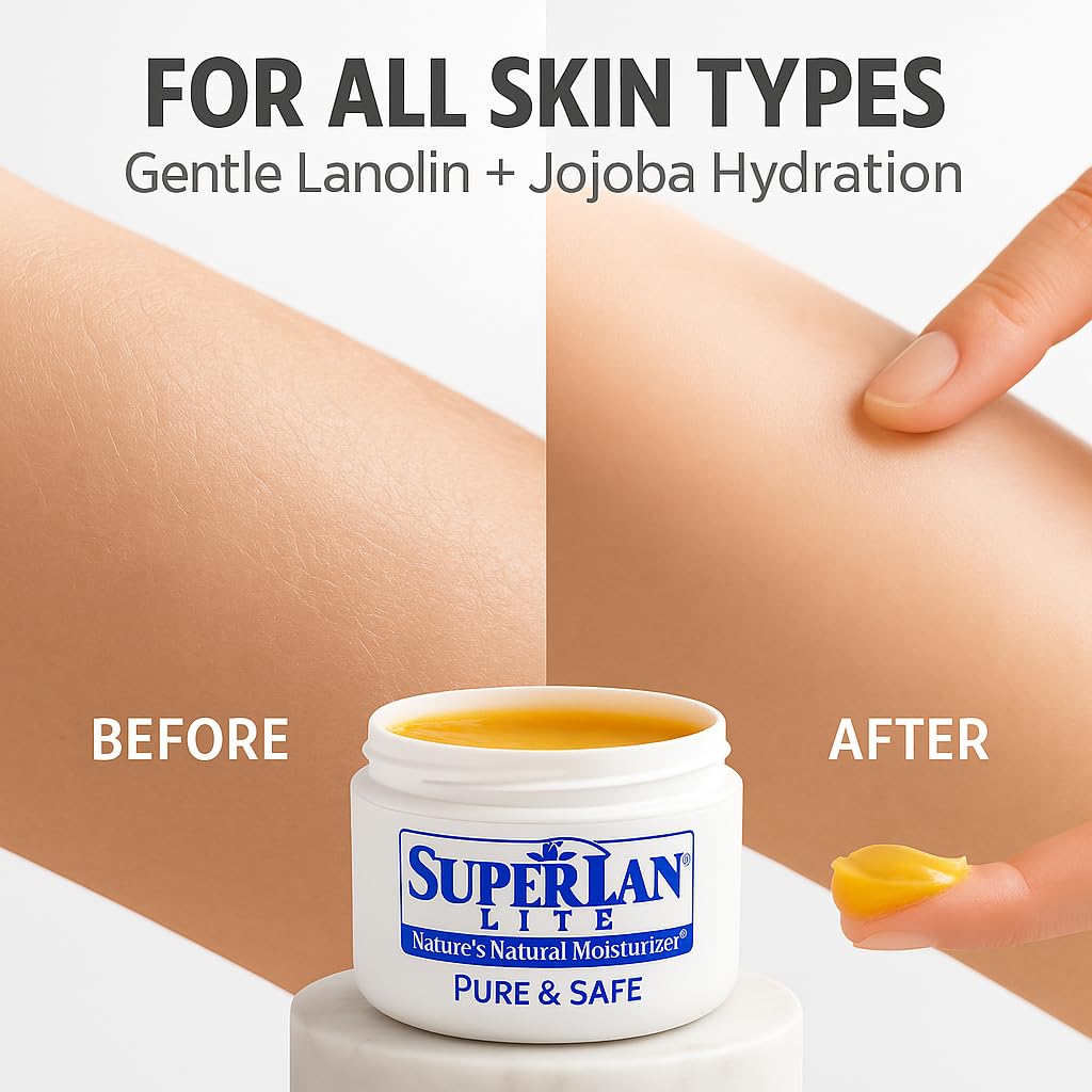 SuperlanÃ‚® Lite Moisturizer Ultra Pure Medical Grade Refined Lanolin 4.0 Oz. by SuperLan