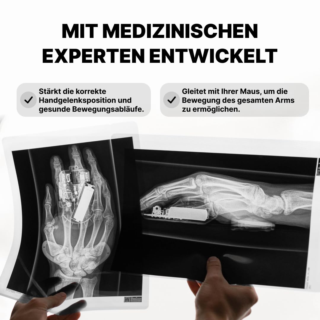 DELTAHUB Carpio 2.0 - ergonomische Handgelenkauflage für Rechtshänder, Handgelenkstütze bei Benutzung der PC-Maus, Reduziert Überstreckung Ermüdung & Handgelenkschmerz leichtes Gleiten - Large/Schwarz