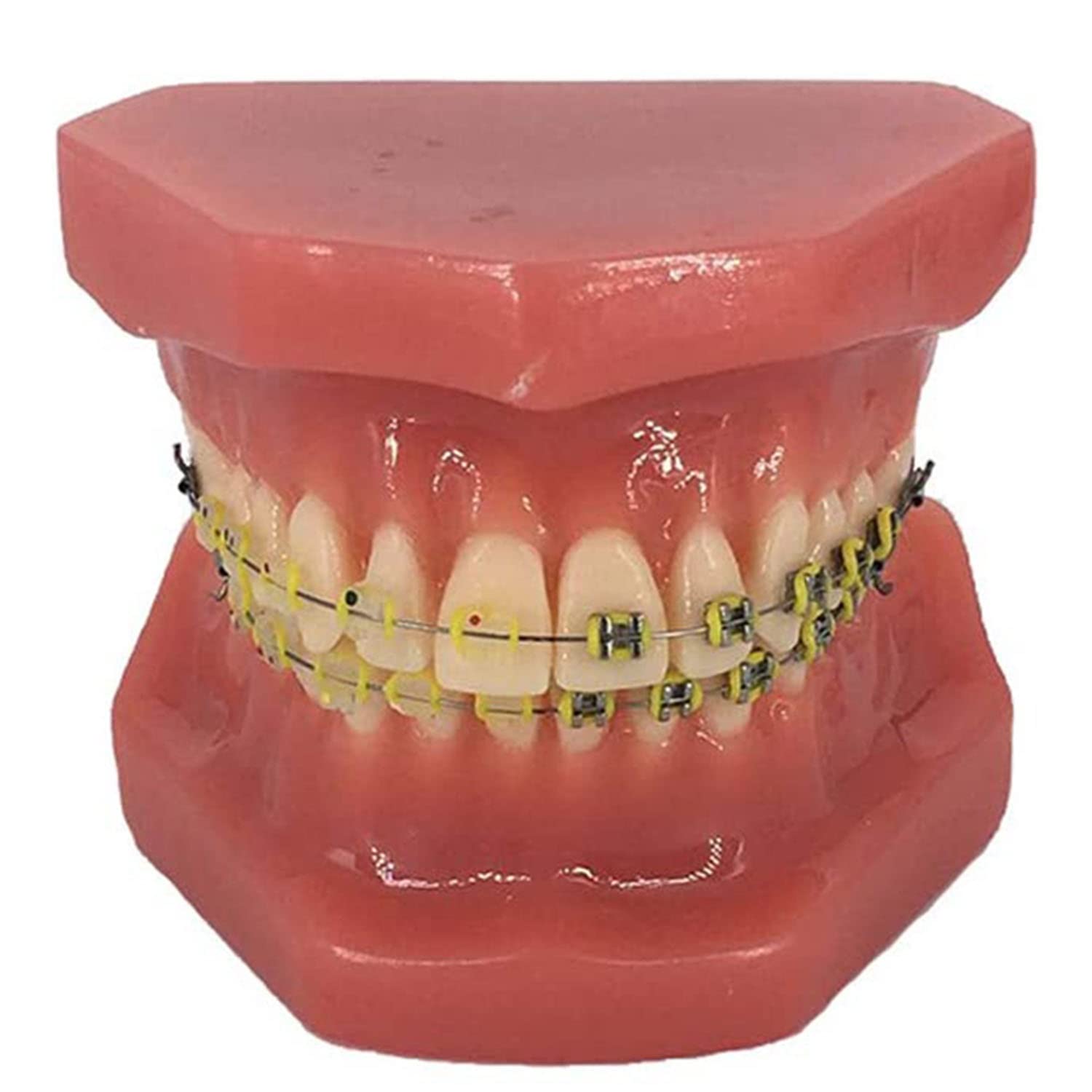 Modello ortodontico dei denti dentali con staffe in metallo e ceramica, tipodonte dentale che studia il modello didattico, modello di dimostrazione orale per il dentista per comunicare con i pazienti