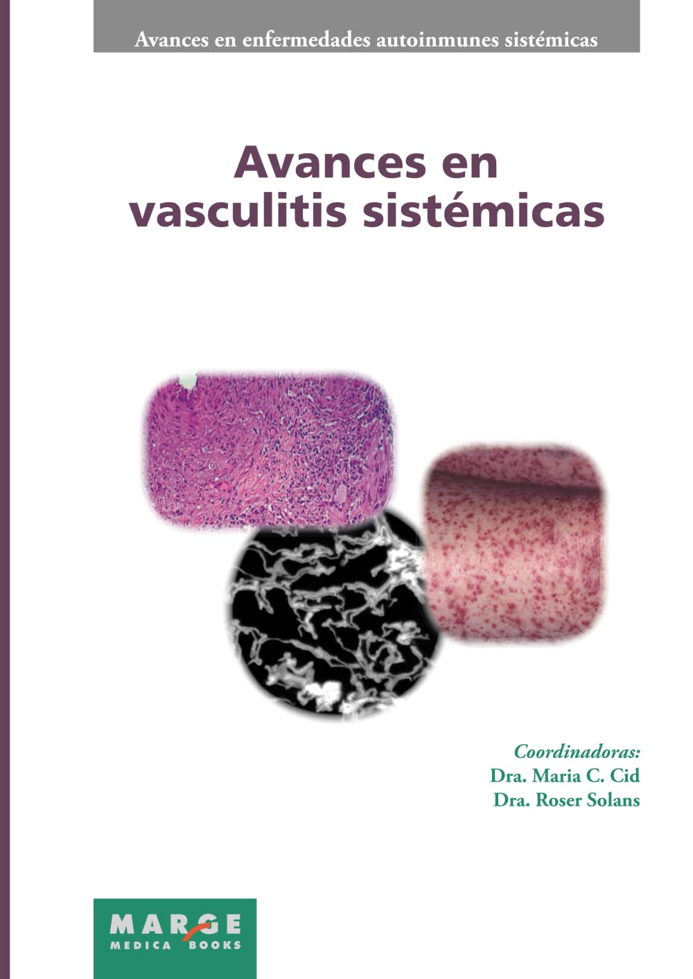 Avances en vasculitis sistmicas : Solans, Roser, Cid, Mara C, Cervera,  Ricard: Amazon.sg: Books