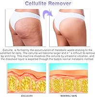 Vista 4 de Dispositivo de belleza corporal de luz roja para uso doméstico