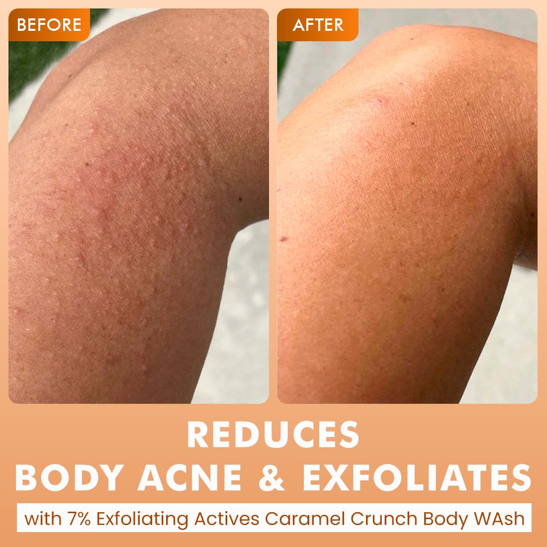 mCaffeine De-Tan & Exfoliating Body Washes (Set of 2) | Guava & Caramel Crunch Body Washes (300 ml x 2) | With Niacinamide, Salicylic and Lactic Acid | Brightens & Even Tones | Reduces Body Acne | 2