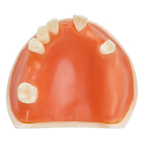 Ultrassist Modelo de implante dental maxilar, modelo básico de entrenamiento de implantes con práctica de encías blandas, gran diente de