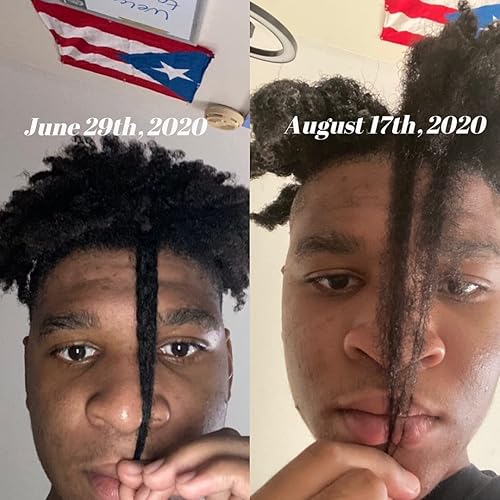 Miniatura 6 de CWHaircare Set de crecimiento, el kit de iniciación de 2 piezas para el cuidado del cabello CW ayuda a hacer crecer tus bordes y coronar la espalda