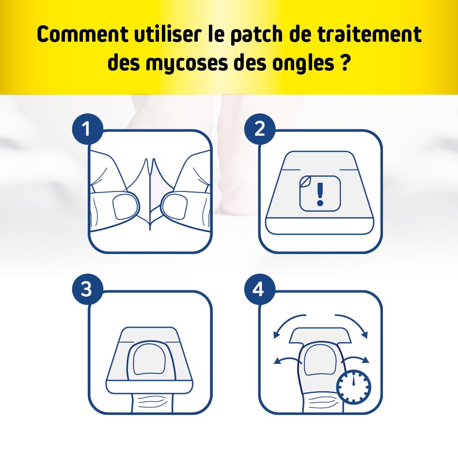 Patch de traitement des mycoses des ongles | Mycose des ongles | Alternative à la crème antifongique | Traitement du pied d'athlète